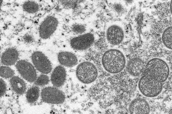 Monkeypox virus on the left